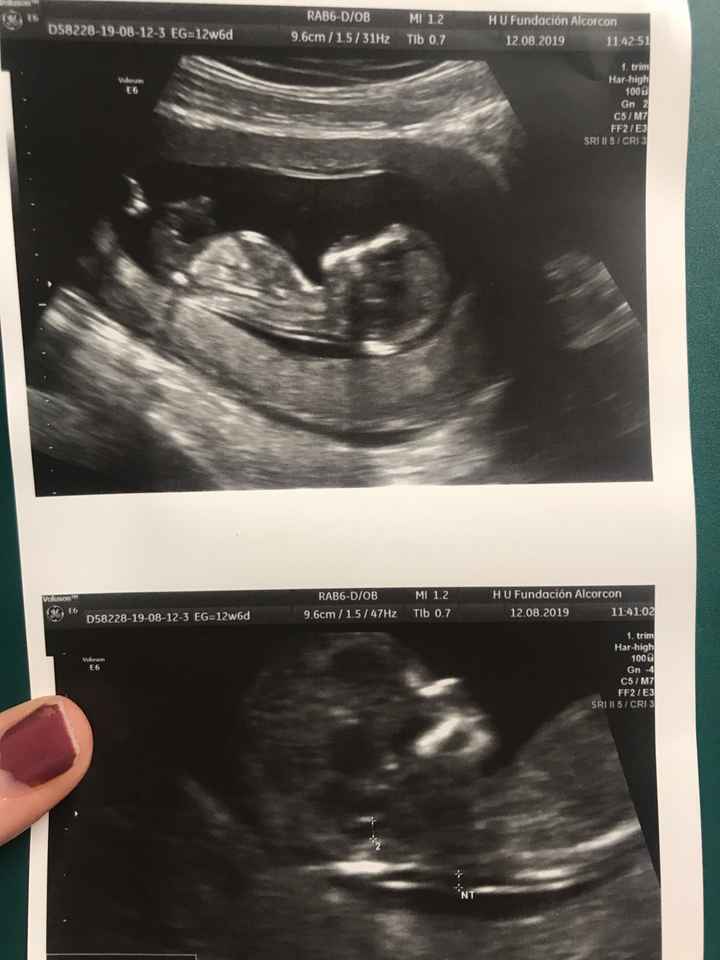 Mamas Febrero 2020 - 1