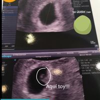 Eco de 6 semanas