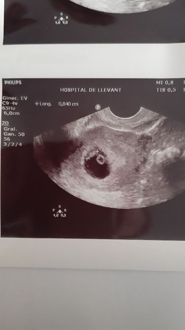 Futuras mamas octubre 2020 - 1