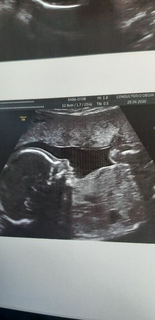 Futuras mamas octubre 2020 - 1