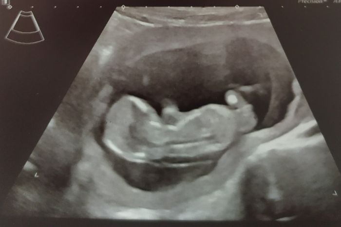 futuras mamis mayo 2022 🤰 1