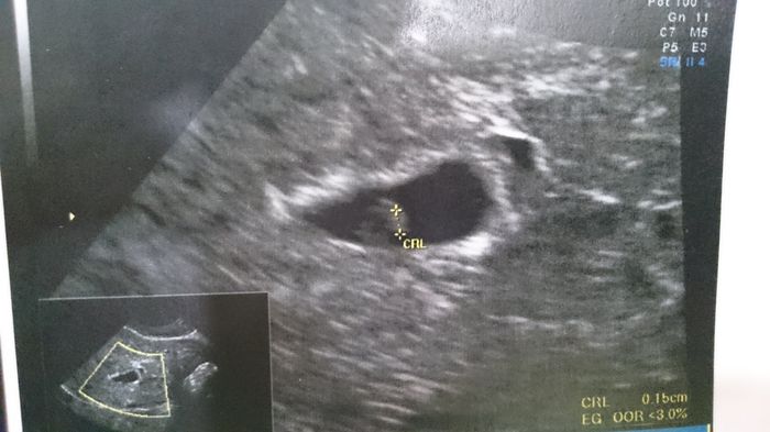 Mamás noviembre 2015 - 1