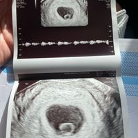 Futuras mamis Junio 2023 - 1