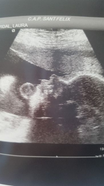 Futuras mamás enero 2019 - 1