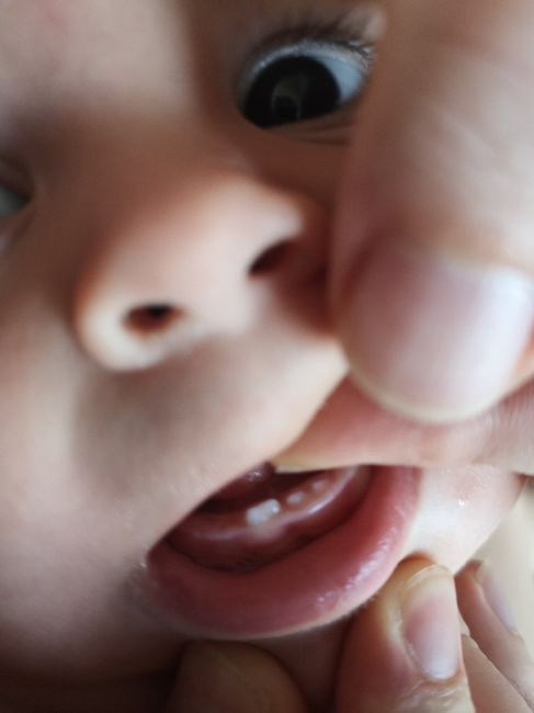 Dudas dientes bebe 1
