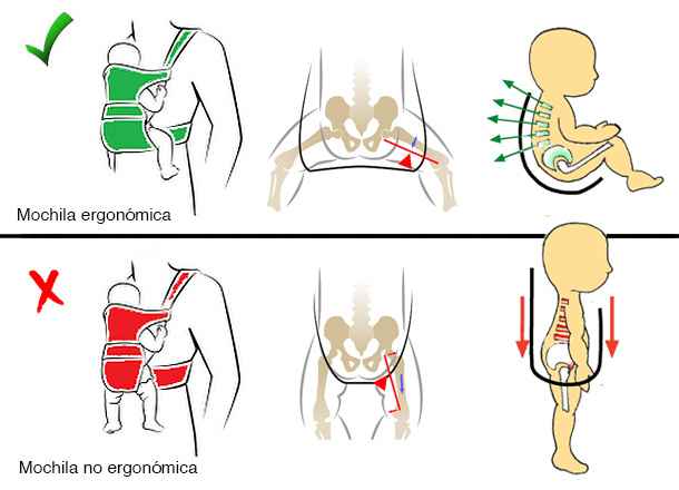 Mochila ergonomica vs mochila no ergonomica