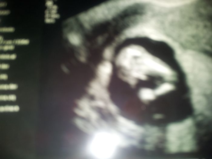 la pilililla de mi niño!!