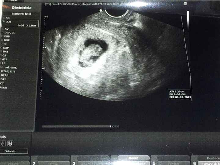 mi lentejita con 9 semanitas!