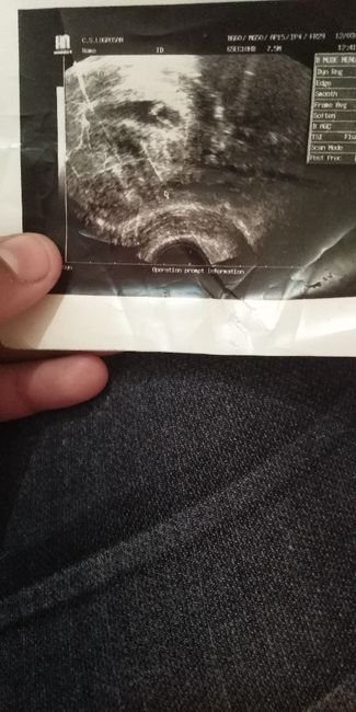 Que creéis será niño o niña? - 1