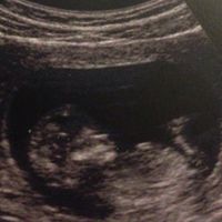 El consultorio de Lita para futuras mamis - 1