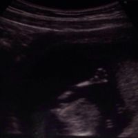 El consultorio de Lita para futuras mamis - 1
