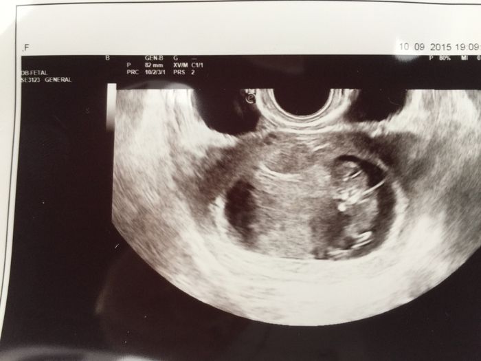 Mamis abril 2016 - 1