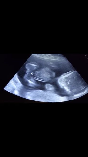 Mamis abril 2016 - 1