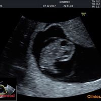  Futuras Mamis Julio 2018 - 1
