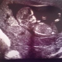 El consultorio de Lita para futuras mamis - 1