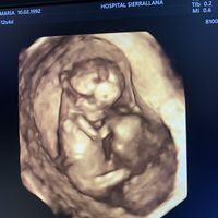 Futuras mamás Abril 2023 (actualizado) - 1