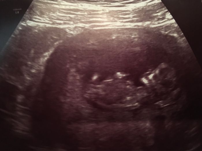 Futuras mamás Mayo 2021🤰♥️ - 2