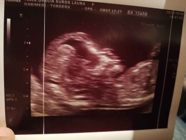 Futuras mamás Mayo 2019 - 2