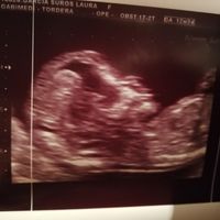 Futuras mamás Mayo 2019 - 2