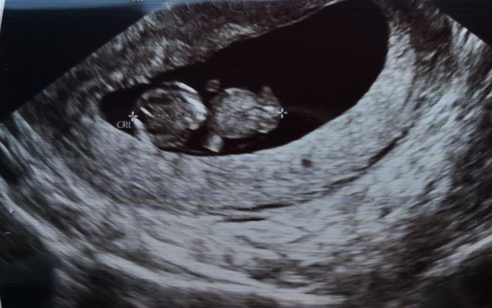 Futuras mamas Diciembre 2020 - 1