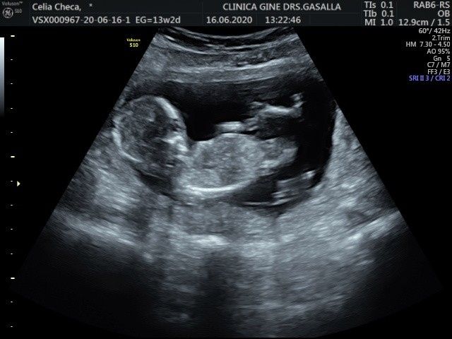 Futuras mamas Diciembre 2020 - 1