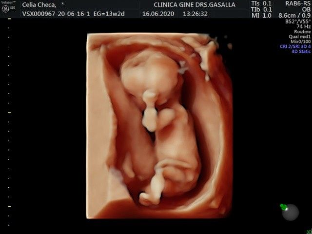 Futuras mamas Diciembre 2020 - 2