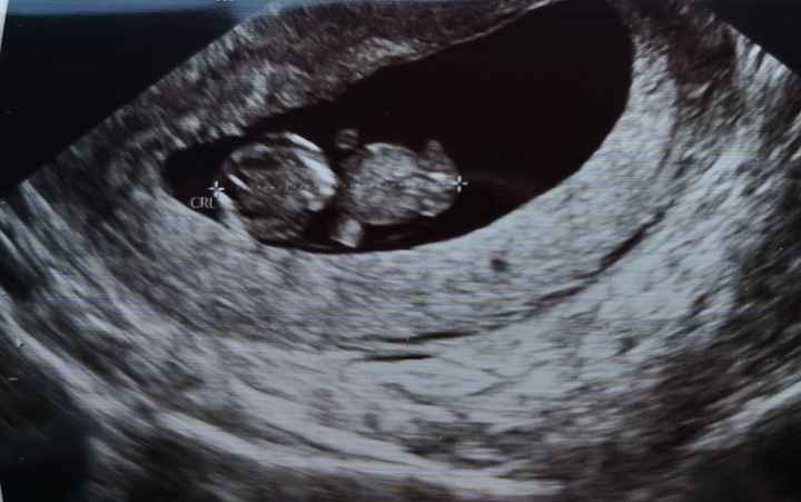Futuras mamas Diciembre 2020 - 1
