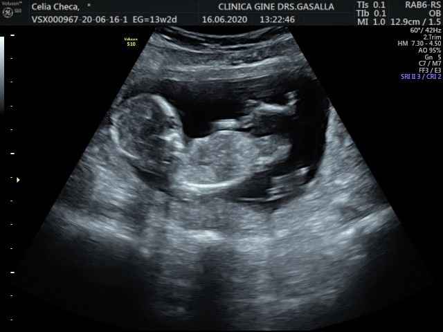 Futuras mamas Diciembre 2020 - 1