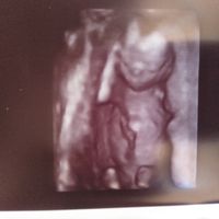Futuras mamás agosto 2019 - 1