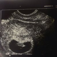 Super mamis de  Junio del 2015 - 1