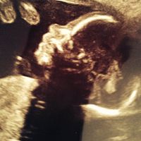 Super mamis de  Junio del 2015 - 2