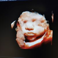 Futuras mamás agosto 2019 - 1