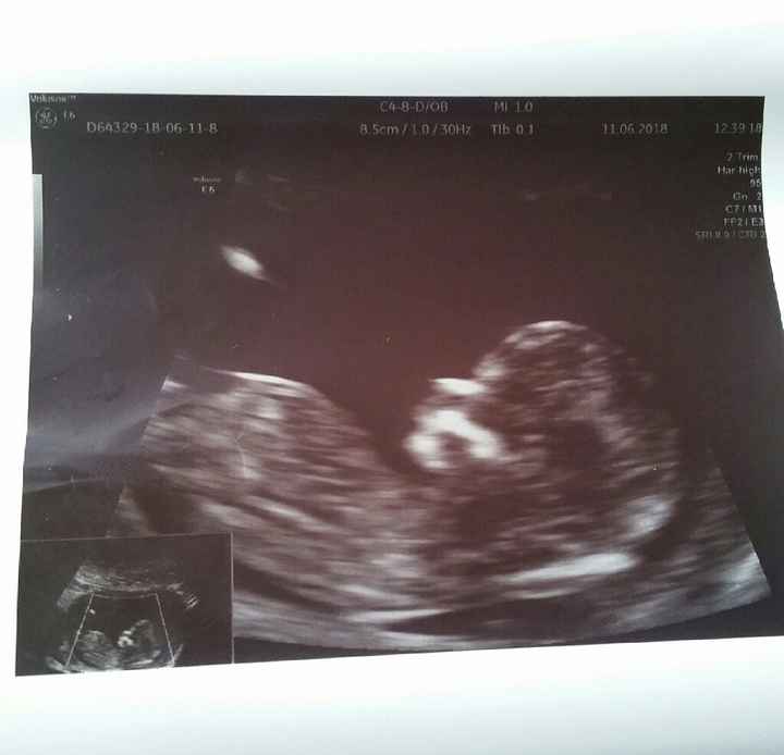 Futuras mamás Diciembre 2018 - 1