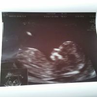 Futuras mamás Diciembre 2018 - 1