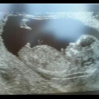 El consultorio de Lita para futuras mamis - 1