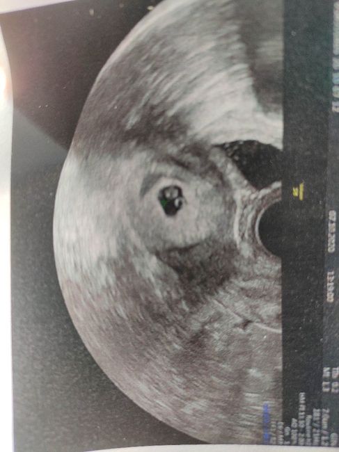 Futuras mamis junio 2021 🤰🏻❤️ oficial - 1