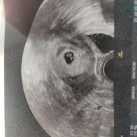 Futuras mamis junio 2021 🤰🏻❤️ oficial - 1