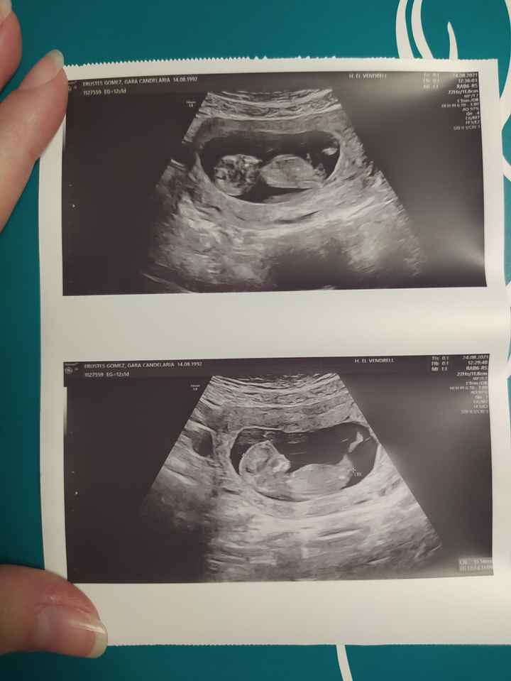 💞 Futuras Mamis marzo 22 🤰🏼 - 1