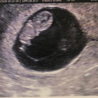 Futuras mamas julio 2019 - 1