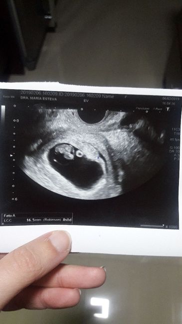 Ayuda con método ramzi: niño o niña? 7