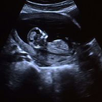 Futuras mamis diciembre 2017 - 1