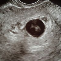 6 semanas