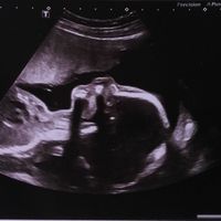 Futuras mamás Mayo 2019 - 1