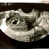 Futuras mamas noviembre 2020 - 1
