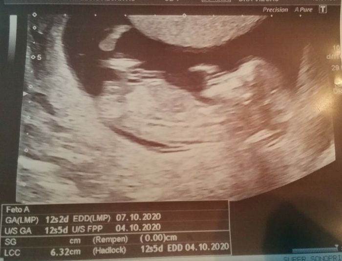 Futuras mamas octubre 2020 - 1