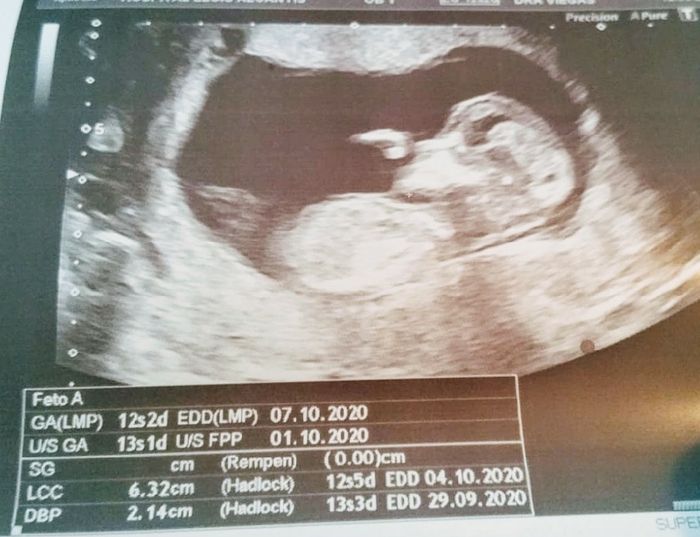 Futuras mamas octubre 2020 - 2