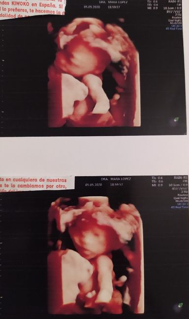 Futuras mamas octubre 2020 - 1