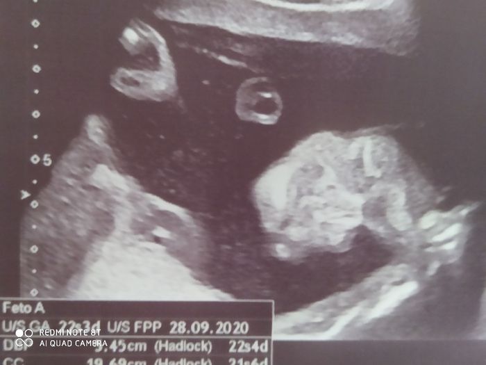 Futuras mamas octubre 2020 - 1