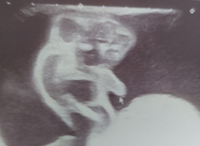 Futuras mamas octubre 2020 - 2