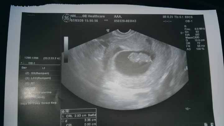 Futuras mamas octubre 2020 - 1